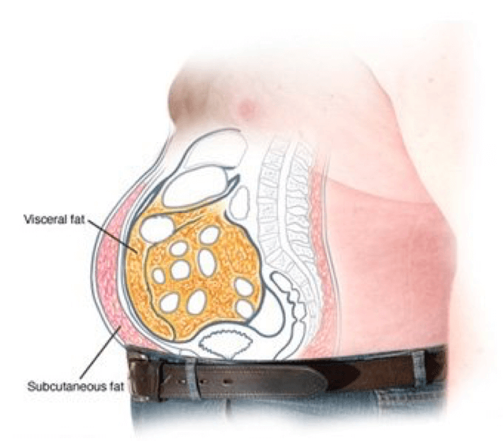 Stubborn Fat Subcutaneous Fat Vs Visceral Fat Elite Body Contouring 7558