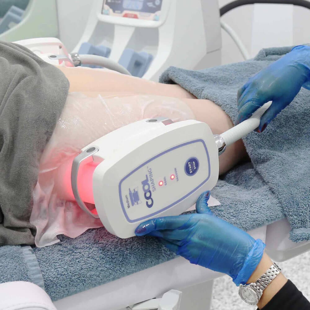 Cryolipolysis Fat freezing on the thigh