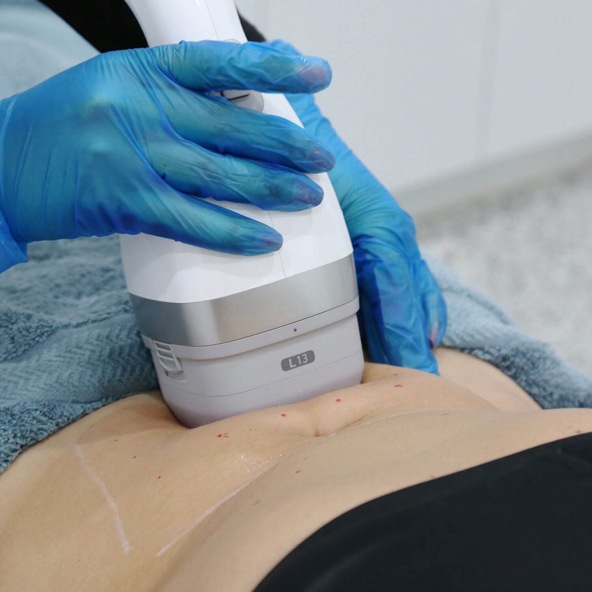 LIPOcel Body Scultping stomach fat reduction