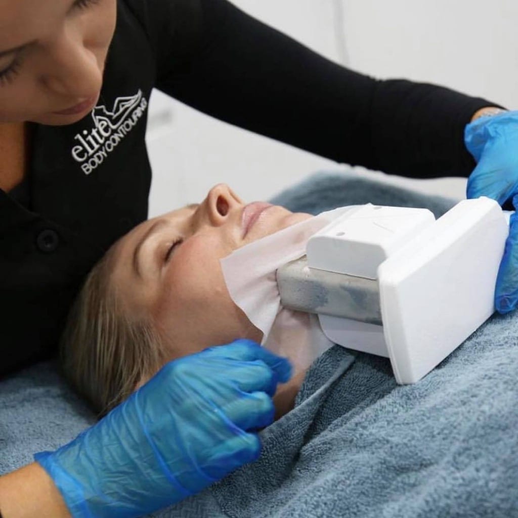 double chin treatment