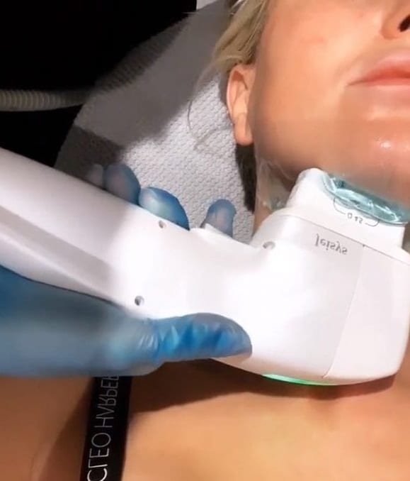 double-chin-treatment-2-584x1024 double-chin-treatment-2-584x1024