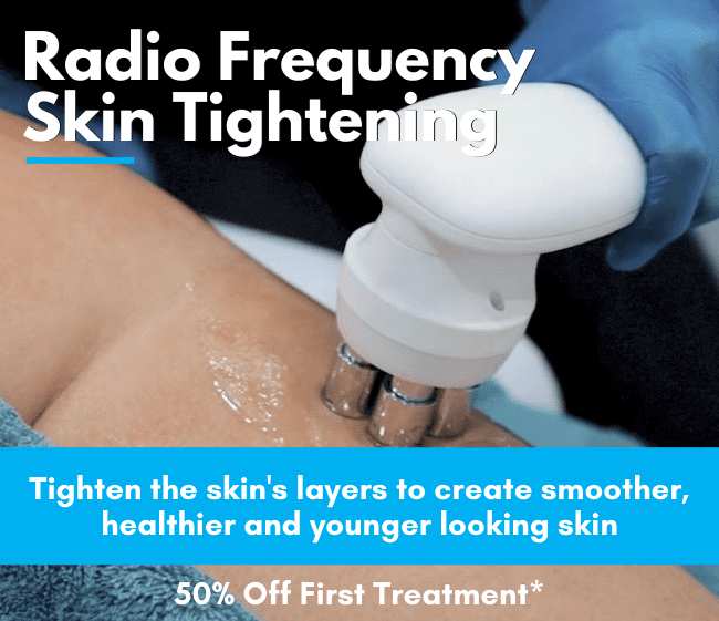 RF Skin Tightening